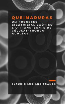 Queimaduras (ebook)