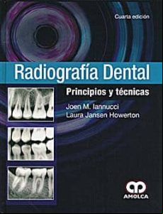RADIOGRAFIA DENTAL: PRINCIPIOS Y TECNICAS