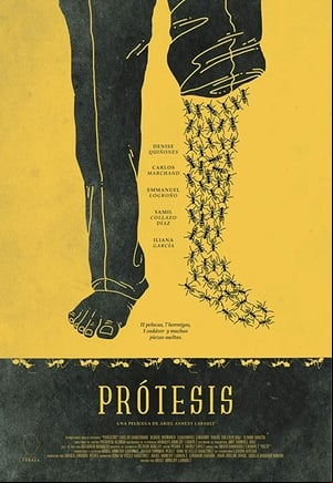 Prótesis Prótesis